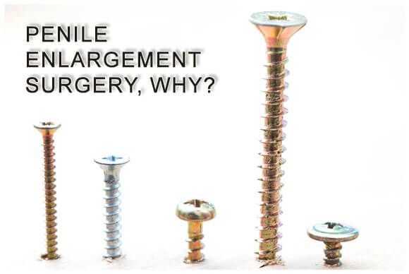 Penis Enlargement Surgery Explained - AskMen
