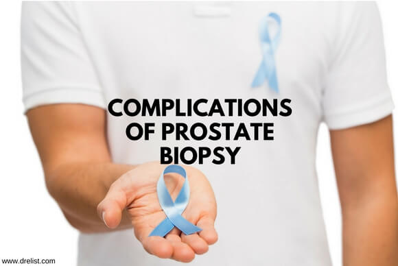 Complications Of Prostate Biopsy Blog